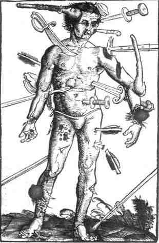 Injuries by medieval axes and swords